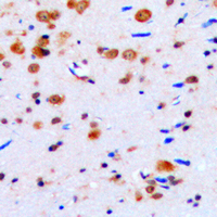 CELF1 / CUGBP1 Antibody - Immunohistochemical analysis of CUGBP1 staining in human brain formalin fixed paraffin embedded tissue section. The section was pre-treated using heat mediated antigen retrieval with sodium citrate buffer (pH 6.0). The section was then incubated with the antibody at room temperature and detected using an HRP conjugated compact polymer system. DAB was used as the chromogen. The section was then counterstained with hematoxylin and mounted with DPX.