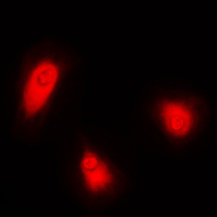 CELF1 / CUGBP1 Antibody - Immunofluorescent analysis of CUGBP1 staining in HeLa cells. Formalin-fixed cells were permeabilized with 0.1% Triton X-100 in TBS for 5-10 minutes and blocked with 3% BSA-PBS for 30 minutes at room temperature. Cells were probed with the primary antibody in 3% BSA-PBS and incubated overnight at 4 C in a humidified chamber. Cells were washed with PBST and incubated with a DyLight 594-conjugated secondary antibody (red) in PBS at room temperature in the dark. DAPI was used to stain the cell nuclei (blue).