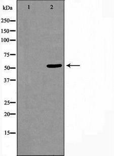 CELF1 / CUGBP1 Antibody - Western blot analysis of extracts of HeLa cells using CELF-1 antibody. The lane on the left is treated with the antigen-specific peptide.