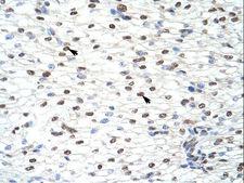CELF2 / CUGBP2 Antibody - CELF2 / CUGBP2 antibody ARP40323_T100-NP_006552-CUGBP2 (CUG triplet repeat, RNA binding protein 2) Antibody was used in IHC to stain formalin-fixed, paraffin-embedded human heart.  This image was taken for the unconjugated form of this product. Other forms have not been tested.