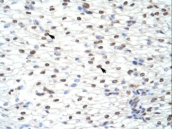 CELF2 / CUGBP2 Antibody - CELF2 / CUGBP2 antibody ARP40323_T100-NP_006552-CUGBP2 (CUG triplet repeat, RNA binding protein 2) Antibody was used in IHC to stain formalin-fixed, paraffin-embedded human heart.  This image was taken for the unconjugated form of this product. Other forms have not been tested.