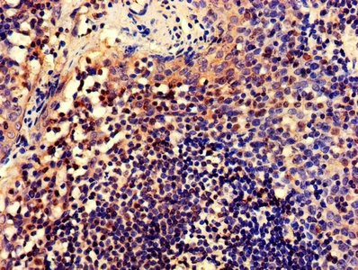 CELF2 / CUGBP2 Antibody - Immunohistochemistry Dilution at 1:600 and staining in paraffin-embedded human tonsil tissue performed on a Leica BondTM system. After dewaxing and hydration, antigen retrieval was mediated by high pressure in a citrate buffer (pH 6.0). Section was blocked with 10% normal Goat serum 30min at RT. Then primary antibody (1% BSA) was incubated at 4°C overnight. The primary is detected by a biotinylated Secondary antibody and visualized using an HRP conjugated SP system.