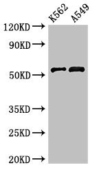 CELF2 / CUGBP2 Antibody - Western Blot Positive WB detected in:K562 whole cell lysate,A549 whole cell lysate All Lanes:CELF2 antibody at 3µg/ml Secondary Goat polyclonal to rabbit IgG at 1/50000 dilution Predicted band size: 55,53,56 KDa Observed band size: 55 KDa