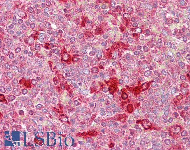CELF2 / CUGBP2 Antibody - Anti-CELF2 / CUGBP2 antibody IHC of human spleen. Immunohistochemistry of formalin-fixed, paraffin-embedded tissue after heat-induced antigen retrieval. Antibody concentration 5 ug/ml.  This image was taken for the unconjugated form of this product. Other forms have not been tested.