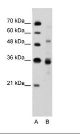 CELF3 Antibody - A: Marker, B: Jurkat Cell Lysate.  This image was taken for the unconjugated form of this product. Other forms have not been tested.