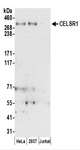CELSR1 Antibody - Detection of Human CELSR1 by Western Blot. Samples: Whole cell lysate (50 ug) prepared using NETN buffer from HeLa, 293T, and Jurkat cells. Antibodies: Affinity purified rabbit anti-CELSR1 antibody used for WB at 0.1 ug/ml. Detection: Chemiluminescence with an exposure time of 3 minutes.