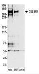 CELSR1 Antibody - Detection of Human CELSR1 by Western Blot. Samples: Whole cell lysate (50 ug) prepared using NETN buffer from HeLa, 293T, and Jurkat cells. Antibodies: Affinity purified rabbit anti-CELSR1 antibody used for WB at 0.4 ug/ml. Detection: Chemiluminescence with an exposure time of 3 minutes.