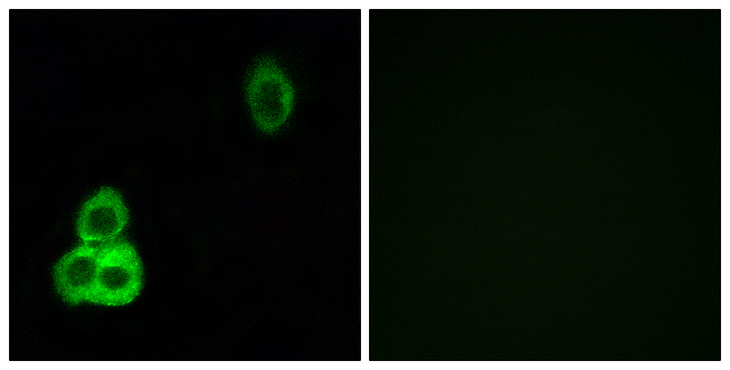CELSR1 Antibody - Immunofluorescence analysis of HepG2 cells, using CELSR1 Antibody. The picture on the right is blocked with the synthesized peptide.