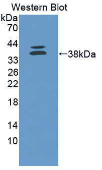 CELSR2 Antibody - Western blot of CELSR2 antibody.