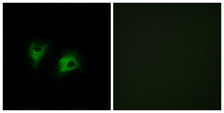CELSR2 Antibody - Immunofluorescence analysis of COS7 cells, using CELSR2 Antibody. The picture on the right is blocked with the synthesized peptide.