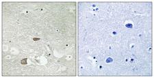 CELSR2 Antibody - Immunohistochemistry analysis of paraffin-embedded human brain tissue, using CELSR2 Antibody. The picture on the right is blocked with the synthesized peptide.