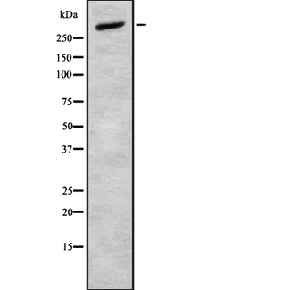 CELSR2 Antibody - Western blot analysis of CELSR2 using MCF-7 whole cells lysates