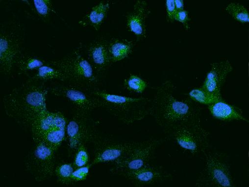 CELSR2 Antibody - Immunofluorescence staining of CELSR2 in U251MG cells. Cells were fixed with 4% PFA, permeabilzed with 0.1% Triton X-100 in PBS, blocked with 10% serum, and incubated with rabbit anti-Human CELSR2 polyclonal antibody (dilution ratio 1:200) at 4°C overnight. Then cells were stained with the Alexa Fluor 488-conjugated Goat Anti-rabbit IgG secondary antibody (green) and counterstained with DAPI (blue). Positive staining was localized to Cytoplasm.