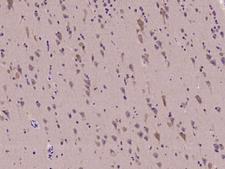 CELSR2 Antibody - Immunochemical staining of human CELSR2 in human brain with rabbit polyclonal antibody at 1:100 dilution, formalin-fixed paraffin embedded sections.