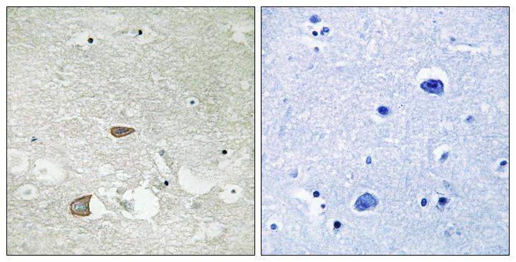 CELSR2 Antibody - Peptide - + Immunohistochemistry analysis of paraffin-embedded human brain tissue using CELSR2 antibody.