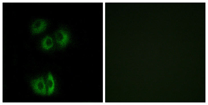 CELSR3 Antibody - Immunofluorescence analysis of A549 cells, using CELSR3 Antibody. The picture on the right is blocked with the synthesized peptide.