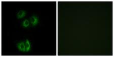 CELSR3 Antibody - Immunofluorescence analysis of A549 cells, using CELSR3 Antibody. The picture on the right is blocked with the synthesized peptide.