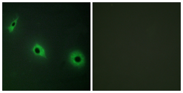 CELSR3 Antibody - Immunofluorescence analysis of HepG2 cells, using CELSR3 Antibody. The picture on the right is blocked with the synthesized peptide.