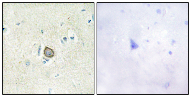 CELSR3 Antibody - Immunohistochemistry analysis of paraffin-embedded human brain tissue, using CELSR3 Antibody. The picture on the right is blocked with the synthesized peptide.