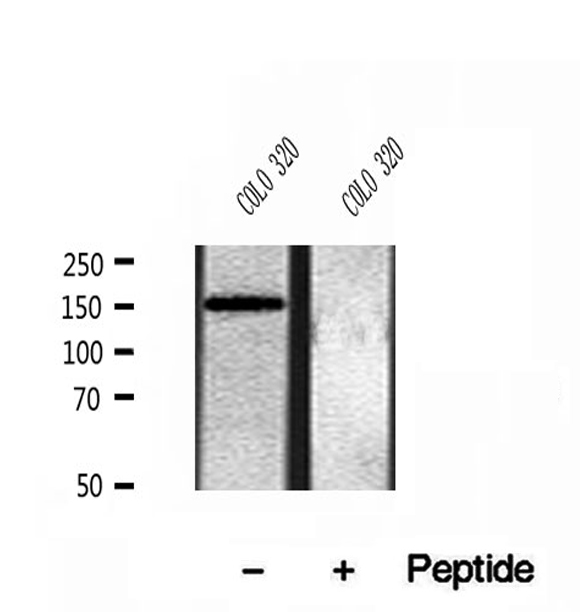 CEMIP / KIAA1199 Antibody - Western blot analysis of extracts of COLO 320 cells using KIAA1199 antibody.