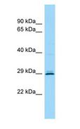 CEMP1 Antibody - CEMP1 antibody Western Blot of HeLa.  This image was taken for the unconjugated form of this product. Other forms have not been tested.