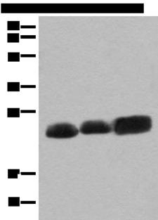 CEND1 Antibody - Western blot analysis of Mouse brain tissue Rat brain tissue and Human cerebrum tissue lysates  using CEND1 Polyclonal Antibody at dilution of 1:500