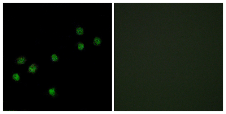 CENPA / CENP-A Antibody - Immunofluorescence analysis of HepG2 cells, using Centromeric Protein A Antibody. The picture on the right is blocked with the synthesized peptide.