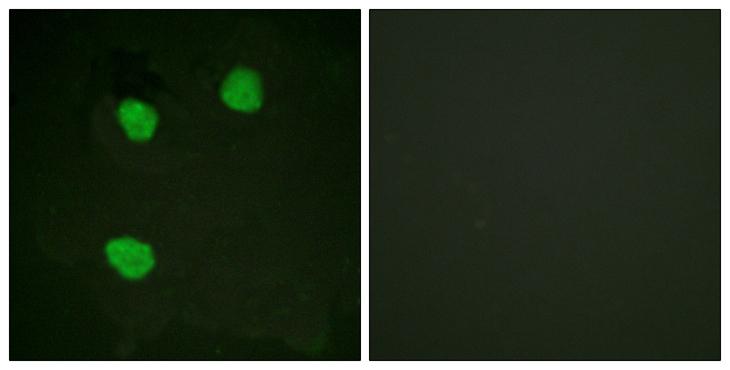 CENPA / CENP-A Antibody - Peptide - + Immunofluorescence analysis of HeLa cells, treated with Forskolin (40nM, 30mins), using Centromeric Protein A antibody.