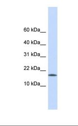CENPA / CENP-A Antibody - Hela cell lysate. Antibody concentration: 1.0 ug/ml. Gel concentration: 10-20%.  This image was taken for the unconjugated form of this product. Other forms have not been tested.