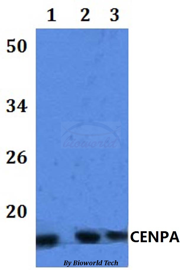 CENPA / CENP-A Antibody - Western blot of CENPA antibody at 1:500 dilution. Lane 1: HEK293T whole cell lysate. Lane 2: Raw264.7 whole cell lysate. Lane 3: H9C2 whole cell lysate.