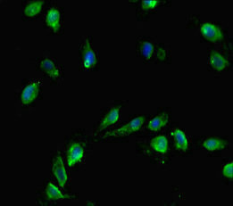 CENPA / CENP-A Antibody - Immunofluorescent analysis of Hela cells diluted at 1:100 and Alexa Fluor 488-congugated AffiniPure Goat Anti-Rabbit IgG(H+L)