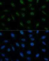 CENPA / CENP-A Antibody - Immunofluorescence analysis of U-2OS cells using CENPA Polyclonal Antibody at dilution of 1:100 (40x lens).Blue: DAPI for nuclear staining.