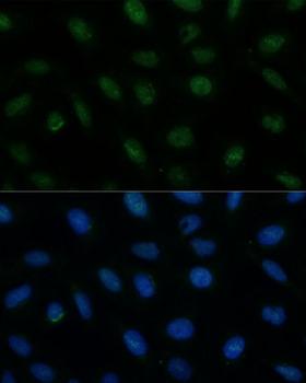 CENPA / CENP-A Antibody - Immunofluorescence analysis of U-2OS cells using CENPA Polyclonal Antibody at dilution of 1:100 (40x lens).Blue: DAPI for nuclear staining.