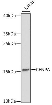 CENPA / CENP-A Antibody - Western blot analysis of extracts of Jurkat cells using CENPA Polyclonal Antibody at dilution of 1:1000.