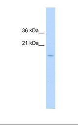CENPA / CENP-A Antibody - Jurkat cell lysate. Antibody concentration: 1.25 ug/ml. Gel concentration: 15%.  This image was taken for the unconjugated form of this product. Other forms have not been tested.