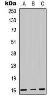 CENPA / CENP-A Antibody - Western blot analysis of CENPA expression in HEK293T (A); Raw264.7 (B); H9C2 (C) whole cell lysates.