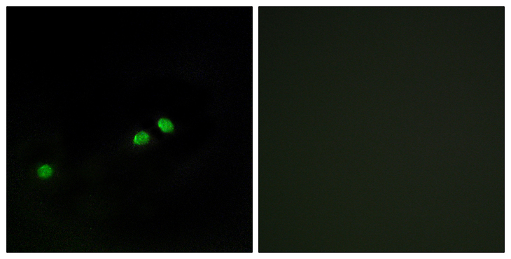 CENPA / CENP-A Antibody - Immunofluorescence analysis of HeLa cells, using Centromeric Protein A (Phospho-Ser7) Antibody. The picture on the right is blocked with the phospho peptide.