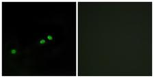CENPA / CENP-A Antibody - Immunofluorescence analysis of HeLa cells, using Centromeric Protein A (Phospho-Ser7) Antibody. The picture on the right is blocked with the phospho peptide.