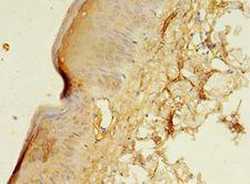 CENPB Antibody - Immunohistochemistry of paraffin-embedded human skin tissue using antibody at 1:100 dilution.  This image was taken for the unconjugated form of this product. Other forms have not been tested.