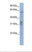 CENPB Antibody - Jurkat cell lysate. Antibody concentration: 1.0 ug/ml. Gel concentration: 12%.  This image was taken for the unconjugated form of this product. Other forms have not been tested.