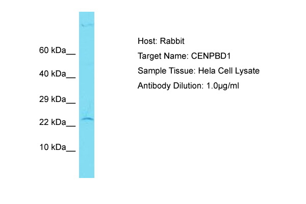 CENPBD1 Antibody -  This image was taken for the unconjugated form of this product. Other forms have not been tested.
