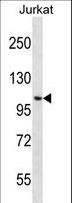 CENPC / CENP-C Antibody - CENPC1 Antibody western blot of Jurkat cell line lysates (35 ug/lane). The CENPC1 antibody detected the CENPC1 protein (arrow).