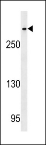 CENPE Antibody - CENPE Antibody western blot of HeLa cell line lysates (35 ug/lane). The CENPE antibody detected the CENPE protein (arrow).