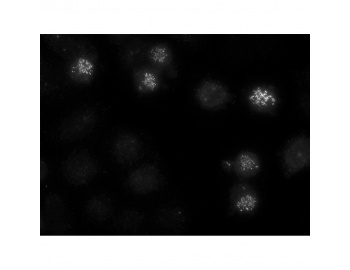 CENPE Antibody - Ovarian cancer cells were arrested with Nocodazole before fixation; primary Ab: anti-CenpE mAb (clone 1H12); Secondary Ab: anti-mouse Alexa 488; chromosome visualization: DAPI