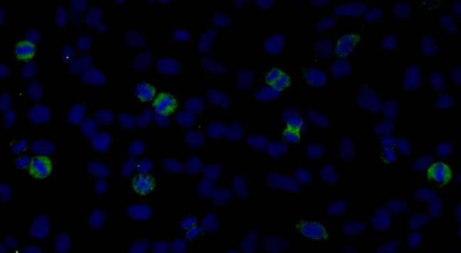 CENPF / CENP-F Antibody - Detection of Human CENP-F by Immunocytochemistry. Samples: Acetone-fixed asynchronous HeLa cells. Antibody: Affinity purified rabbit anti-CENP-F used at a dilution of 1:250. Detection: Anti-rabbit IgG-FITC conjugated used at a dilution of 1:100.