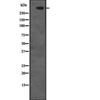 CENPF / CENP-F Antibody - Western blot analysis of CENPF expression in HeLa cells lysate. The lane on the left is treated with the antigen-specific peptide.