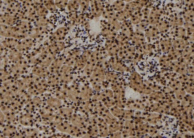 CENPF / CENP-F Antibody - 1:100 staining mouse kidney tissue by IHC-P. The sample was formaldehyde fixed and a heat mediated antigen retrieval step in citrate buffer was performed. The sample was then blocked and incubated with the antibody for 1.5 hours at 22°C. An HRP conjugated goat anti-rabbit antibody was used as the secondary.