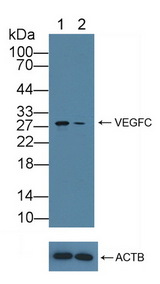 CENPH / CENP-H Antibody - Knockout Varification: Lane 1: Wild-type RAW264.7 cell lysate; Lane 2: CENPH knockout RAW264.7 cell lysate; Predicted MW: 28kd Observed MW: 28kd Primary Ab: 3µg/ml Rabbit Anti-Human CENPH Antibody Second Ab: 0.2µg/mL HRP-Linked Caprine Anti-Rabbit IgG Polyclonal Antibody