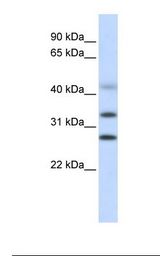 CENPH / CENP-H Antibody - Fetal liver lysate. Antibody concentration: 1.0 ug/ml. Gel concentration: 12%.  This image was taken for the unconjugated form of this product. Other forms have not been tested.