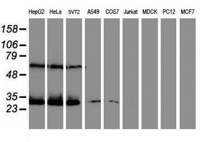 CENPH / CENP-H Antibody - Western blot of extracts (35 ug) from 9 different cell lines by using anti-CENPH monoclonal antibody (HepG2: human; HeLa: human; SVT2: mouse; A549: human; COS7: monkey; Jurkat: human; MDCK: canine; PC12: rat; MCF7: human).